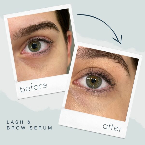 Lashserum Beforeafter