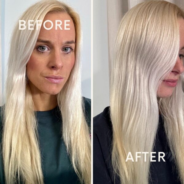 Before After Minimal Skincare Instagram Post (1)
