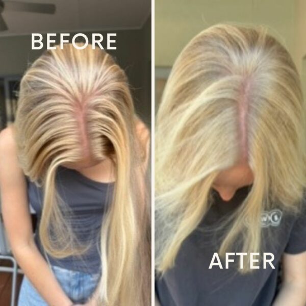 Before After Minimal Skincare Instagram Post